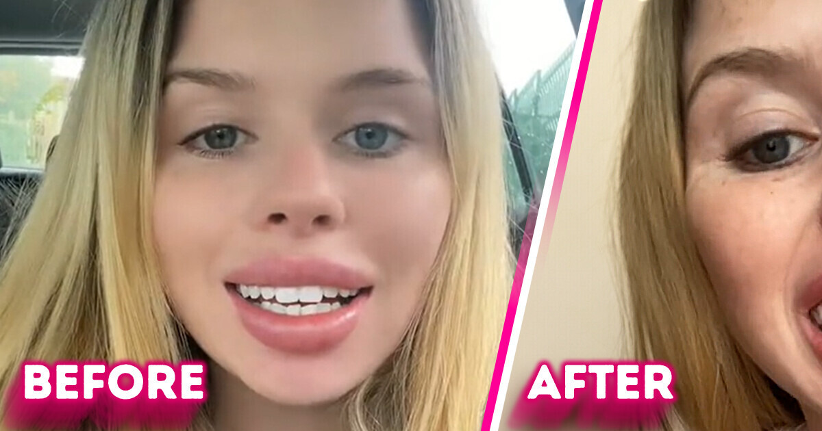A Woman Gets New Veneers on the Cheap, and Her Confused Reaction Quickly Sparks Controversy A Woman Gets New Veneers on the Cheap, and Her Confused Reaction Quickly Sparks Controversy