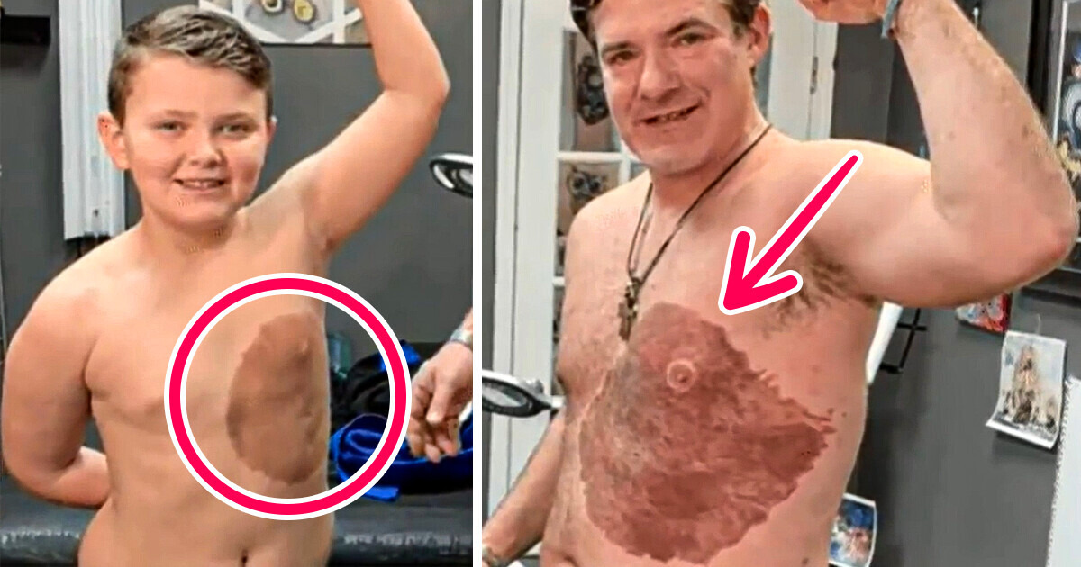 Father Endures 30 HOURS OF PAIN to Get Tattoo Matching His Son’s Birthmark, So He Won’t Feel Ashamed Father Endures 30 HOURS OF PAIN to Get Tattoo Matching His Son’s Birthmark, So He Won’t Feel Ashamed
