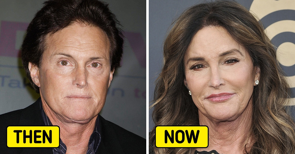 15 Celebrities Who Never Failed To Amaze Us With Their Extraordinary Transformations