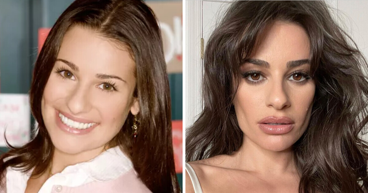 12 Stars Who Changed a Lot After Having Plastic Surgery 12 Stars Who Changed a Lot After Having Plastic Surgery