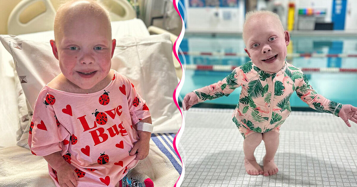 A Girl, 10, Who Has the Body of a One-Year-Old, Survives Many Surgeries, but Faces Online Mockery