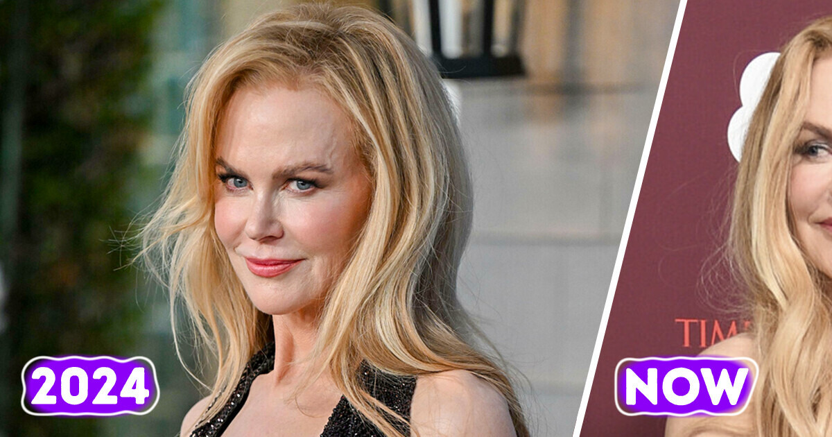 “She Has a New Face!” Nicole Kidman Stuns on the Red Carpet, but Her Appearance Sparks Controversy “She Has a New Face!” Nicole Kidman Stuns on the Red Carpet, but Her Appearance Sparks Controversy