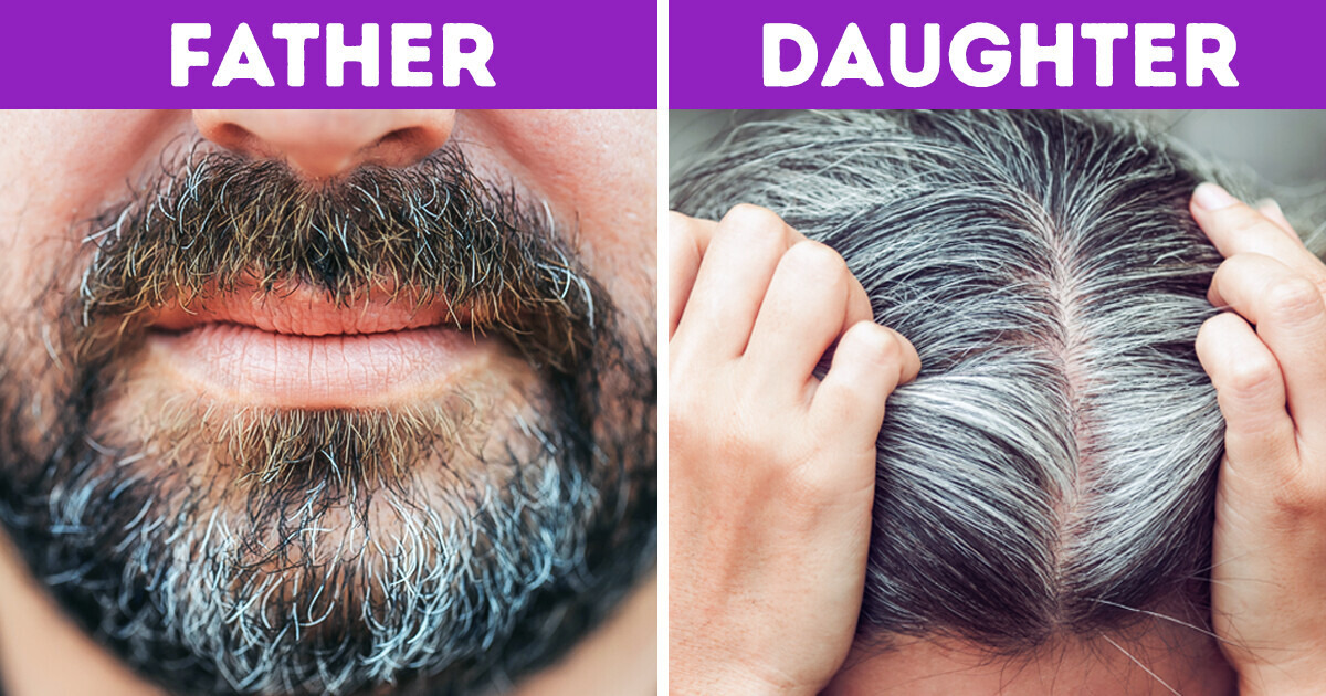 6 Causes of Early Graying You Never Suspected