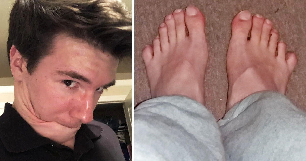 16 People Who Didn’t Win the Lottery But the Gene Jackpot