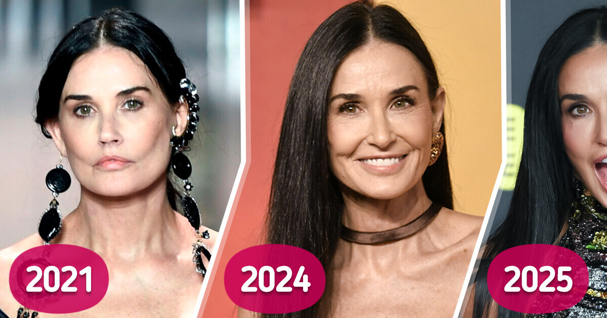Demi Moore Stuns at the BAFTAs 2025, but Her Mouth Sparks Heated Controversy Demi Moore Stuns at the BAFTAs 2025, but Her Mouth Sparks Heated Controversy