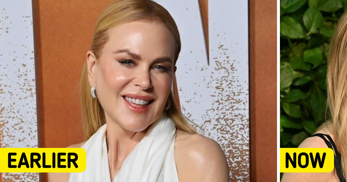 “Starting to Look Like Her Husband,” Nicole Kidman’s Recent Appearance Left People in Shock “Starting to Look Like Her Husband,” Nicole Kidman’s Recent Appearance Left People in Shock