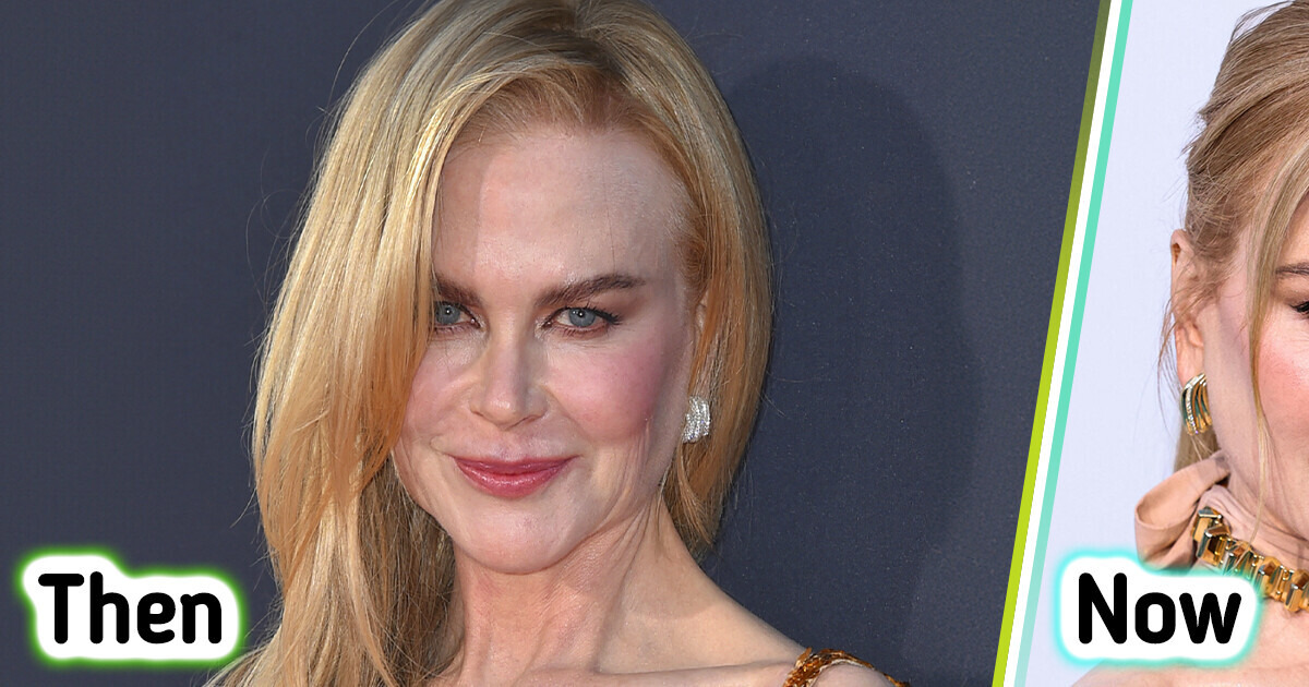 “Let That Go and Age Naturally,” Nicole Kidman Stuns in Nude Dress, but Her Appearance Sparks Heated Controversy “Let That Go and Age Naturally,” Nicole Kidman Stuns in Nude Dress, but Her Appearance Sparks Heated Controversy