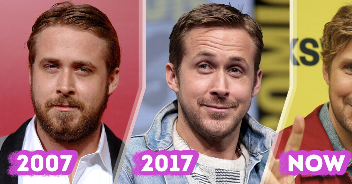 Plastic Surgeon Commented on Ryan Gosling’s Face Changes that Totally Shocked Fans Plastic Surgeon Commented on Ryan Gosling’s Face Changes that Totally Shocked Fans