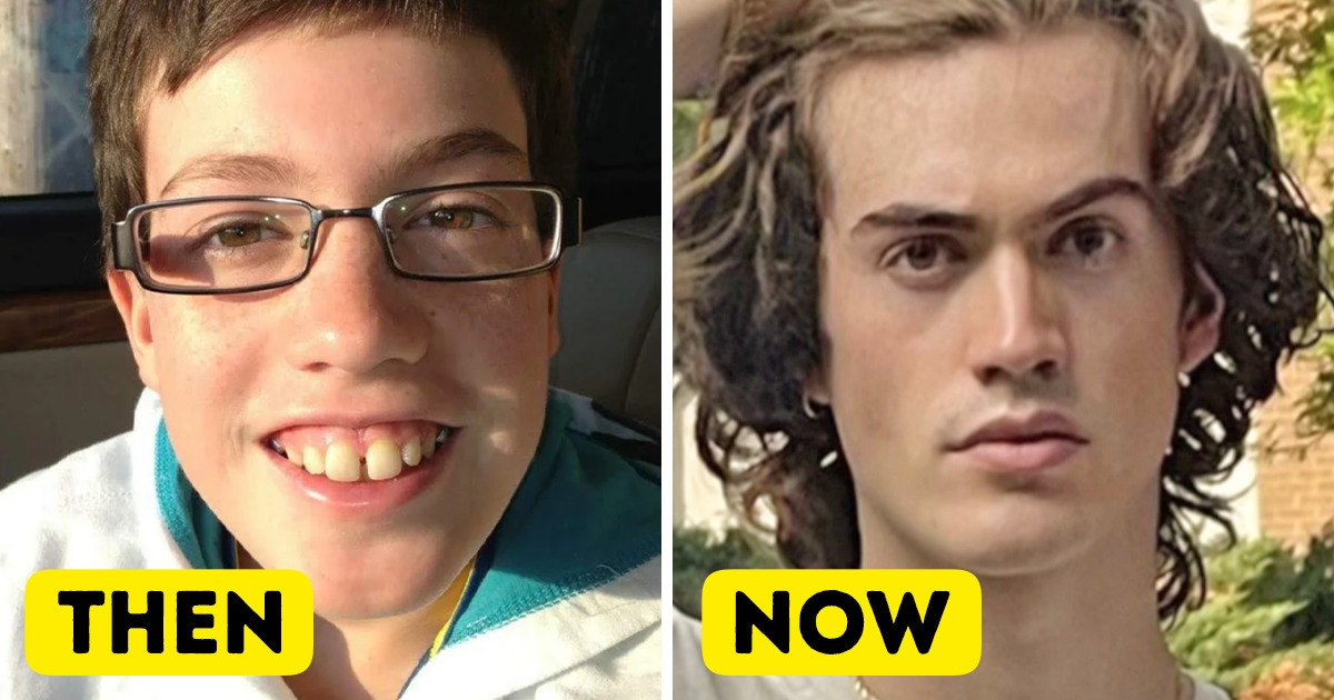 15 People Whose Transformation Through the Years Will Surprise You