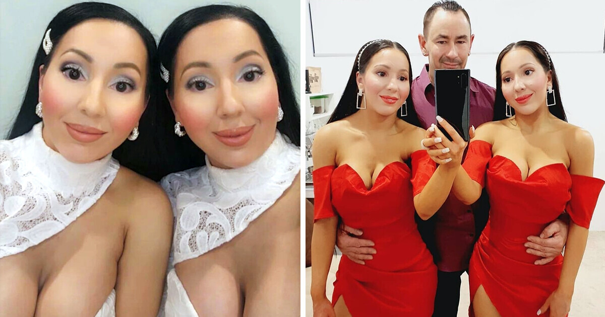 The Worlds Most Identical Twins Are Engaged to the Same Man and Dream to Have Babies Simultaneously The Worlds Most Identical Twins Are Engaged to the Same Man and Dream to Have Babies Simultaneously