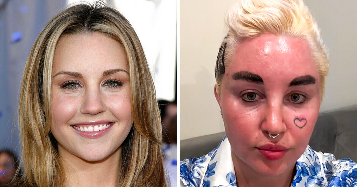 10 Celebrities Who Have Changed Dramatically Over the Years 10 Celebrities Who Have Changed Dramatically Over the Years