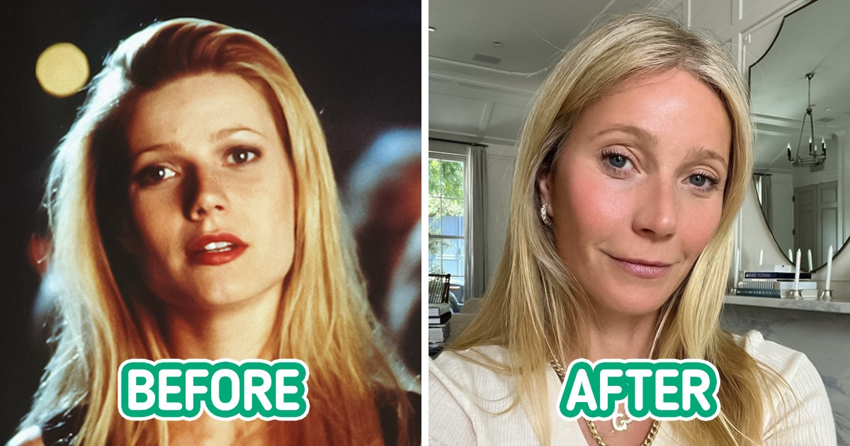 8 Celebs Who Are Not Happy With Cosmetic Procedures Done on Them