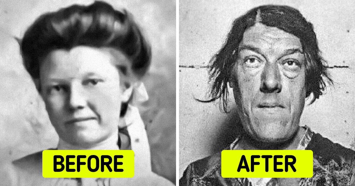 The Tragic Story of a Mother Who Sacrificed Her Beauty to Save Her Children