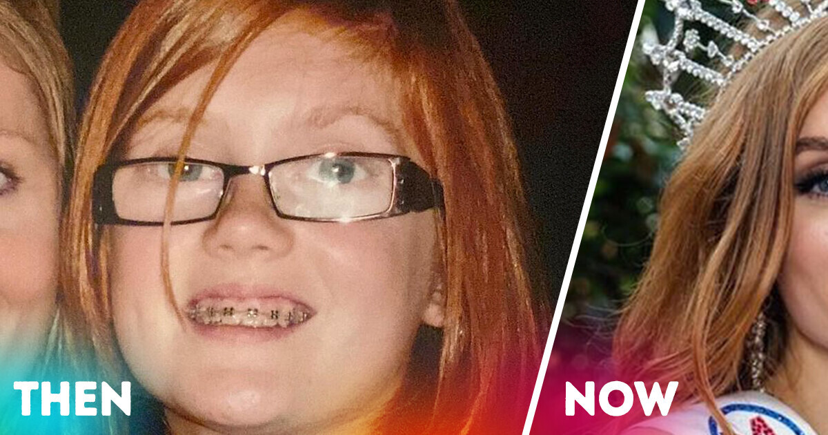 A Girl Who Was Bullied for Her Ginger Locks Has Now Become the First Redhead to Be Miss England