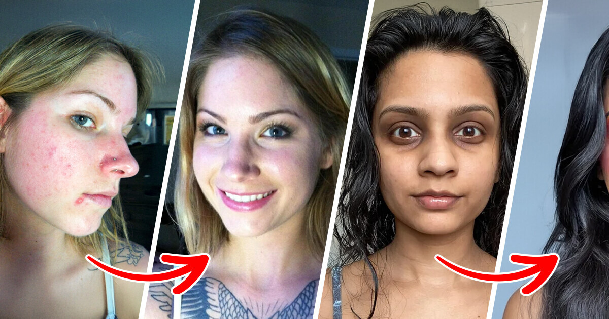 These 20+ Makeup Transformations Prove Beauty Has No Limits