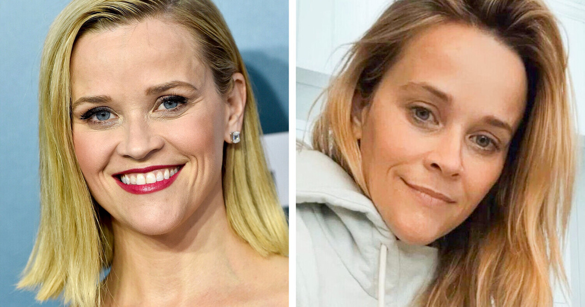 15+ Celebs Who Confidently Shared Their No-Filter Pictures on Social Media