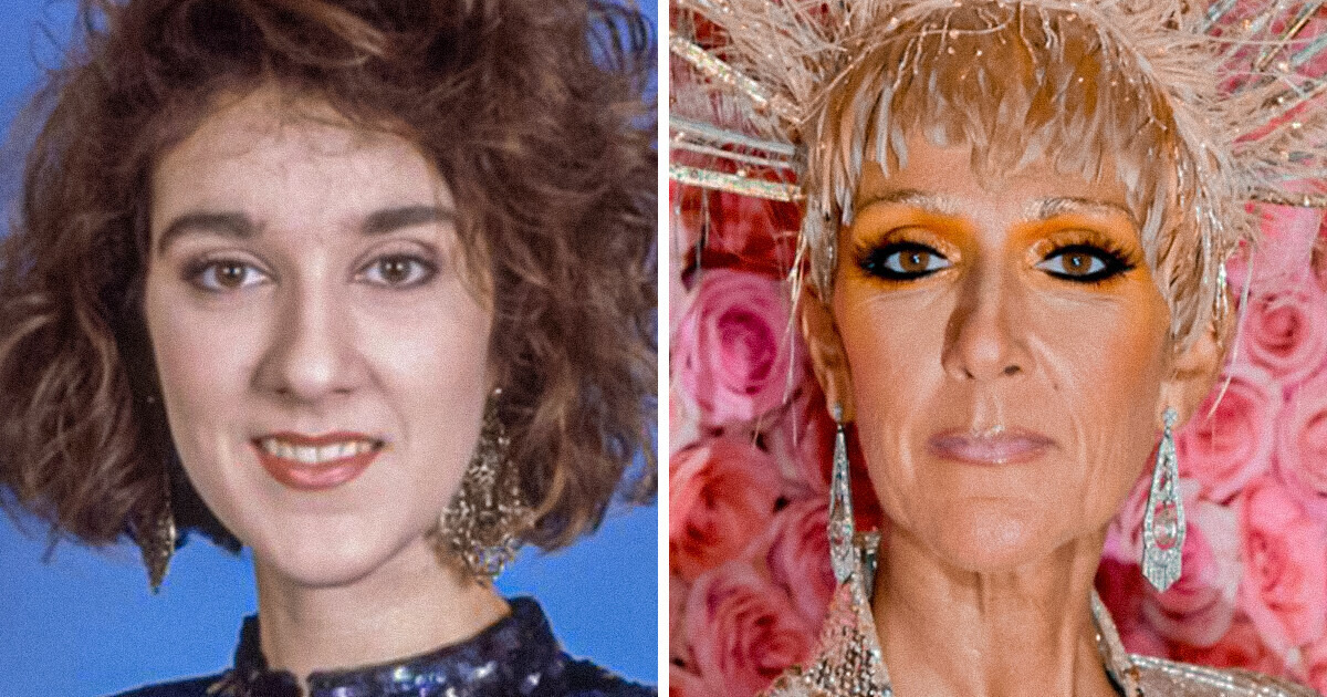 15+ Celebrities Who’ve Considerably Changed As They Grew Older