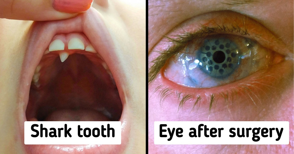 15 People Whose Discoveries Hit Them Right in the Heart