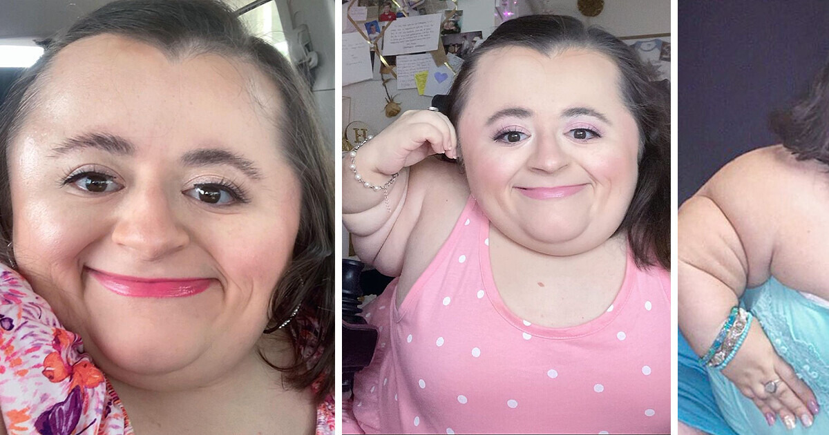 Meet Hannah, Born With a Rare Condition, Who Turned Her Dream Into Reality and Became a Beauty Influencer Meet Hannah, Born With a Rare Condition, Who Turned Her Dream Into Reality and Became a Beauty Influencer