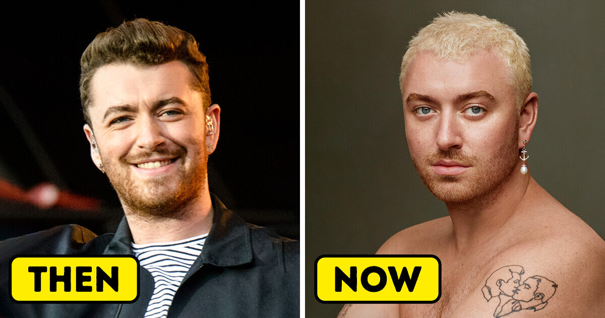 15 Fearless Celebrities Who Underwent Remarkable Style Transformations