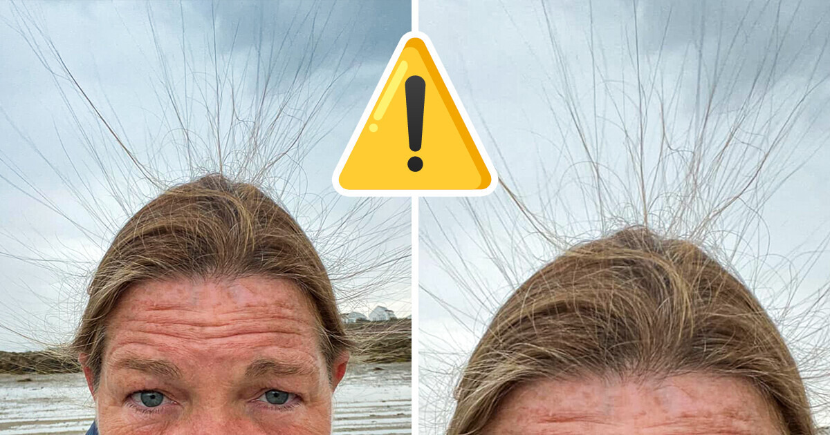 A Woman Cheated Death Without Realizing It, and Here’s Her Caution for Everyone