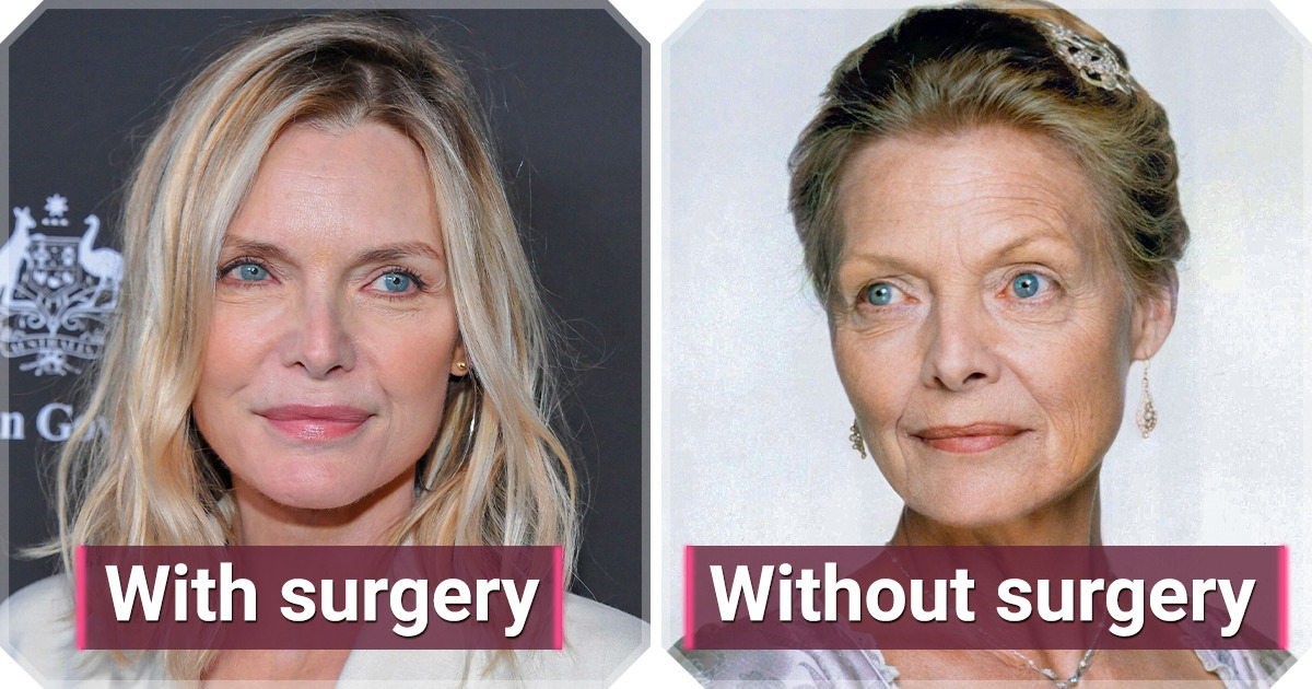 How 12 of Our Favorite Stars Would Look if They Had Said “No” to Cosmetic Procedures How 12 of Our Favorite Stars Would Look if They Had Said “No” to Cosmetic Procedures