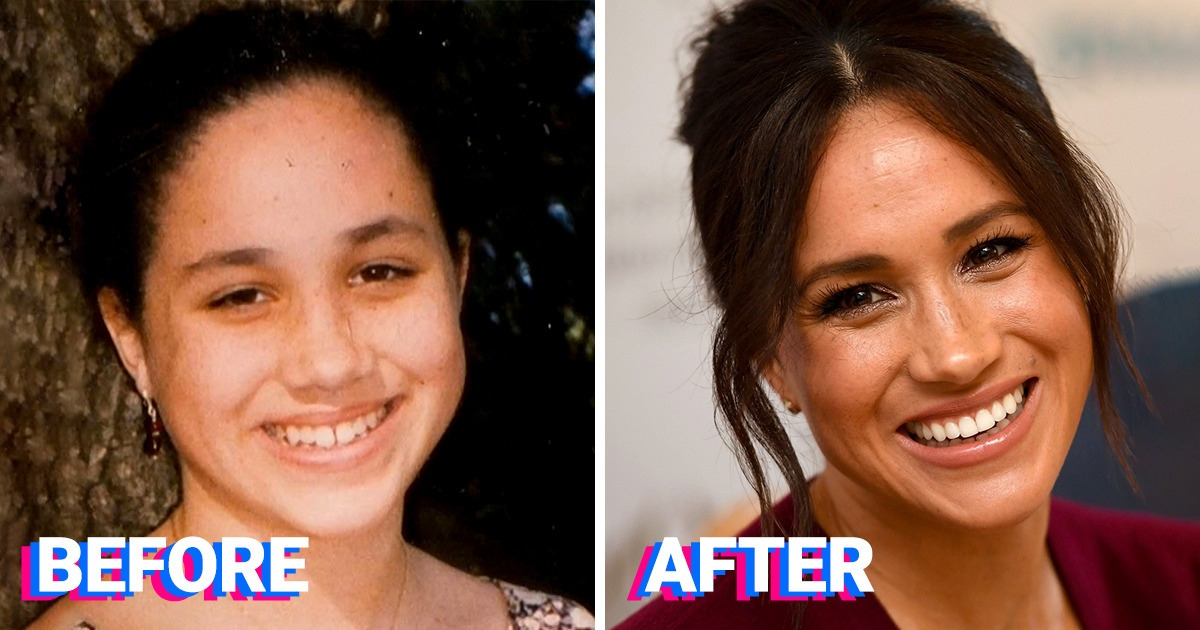 15 Stars Who Upgraded Their Smile and Achieved a New Glow 15 Stars Who Upgraded Their Smile and Achieved a New Glow