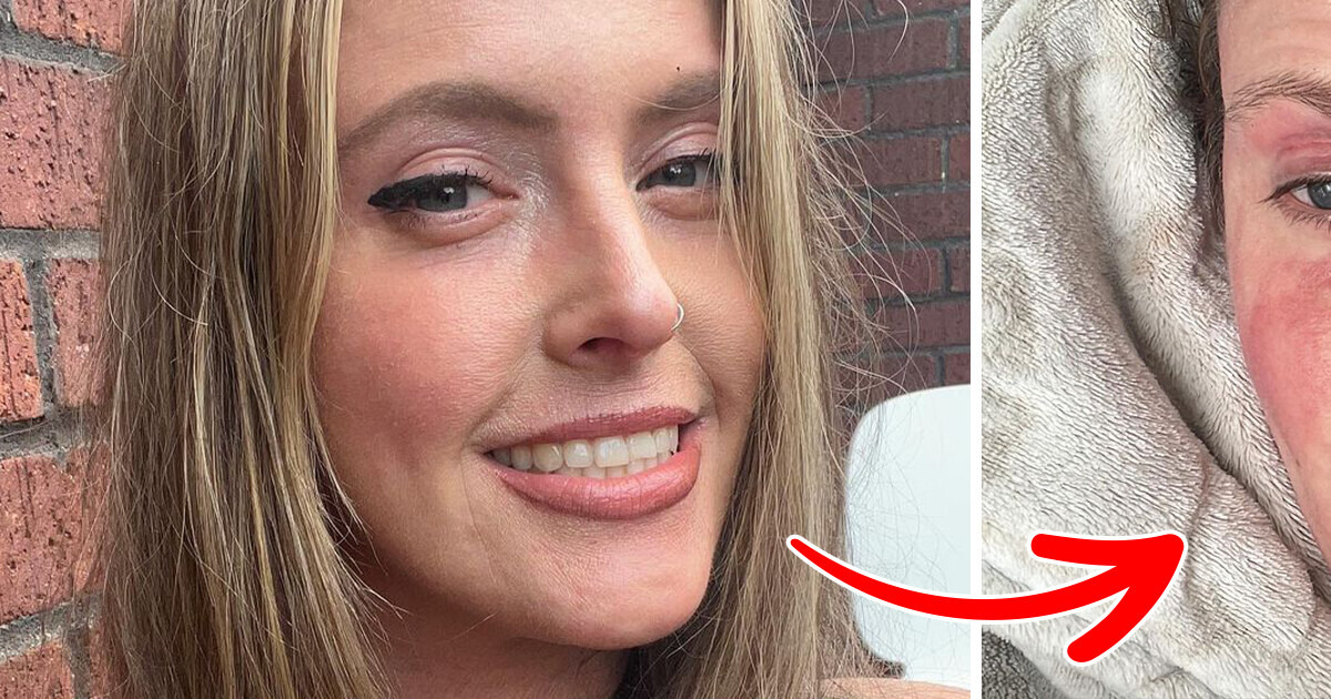 My Tinder Match Blocked Me Once He Saw My Real Skin