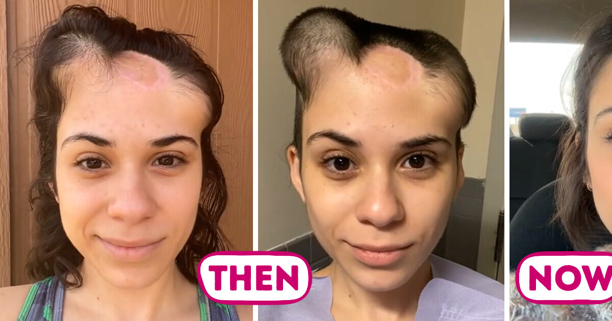 13 People Whose Unbelievable Transformations Made Us Do a Double Take 13 People Whose Unbelievable Transformations Made Us Do a Double Take