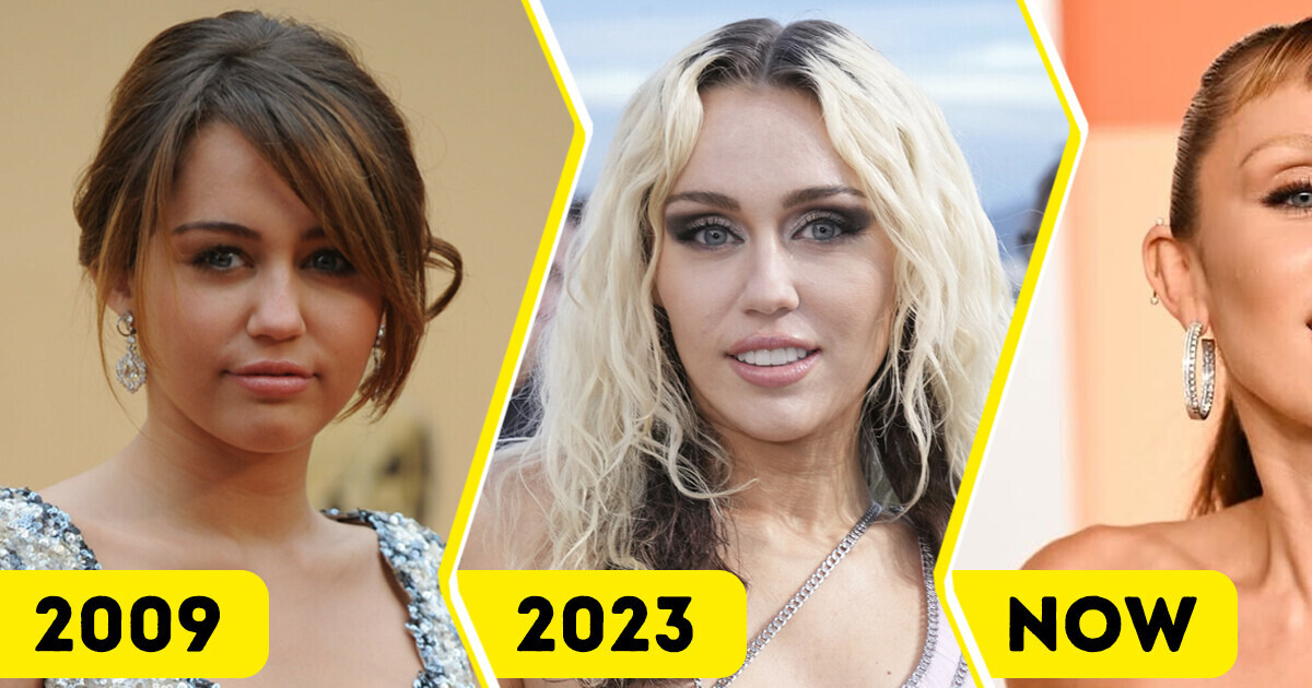 “What Happened to Her Face?” Miley Cyrus’s Bold New Look Divides People and Sparks Heated Debate “What Happened to Her Face?” Miley Cyrus’s Bold New Look Divides People and Sparks Heated Debate