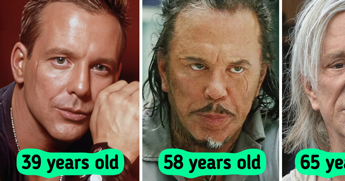 «I Chose the Wrong Surgeon,» Mickey Rourke Went Through Truly Dramatic Face Change «I Chose the Wrong Surgeon,» Mickey Rourke Went Through Truly Dramatic Face Change