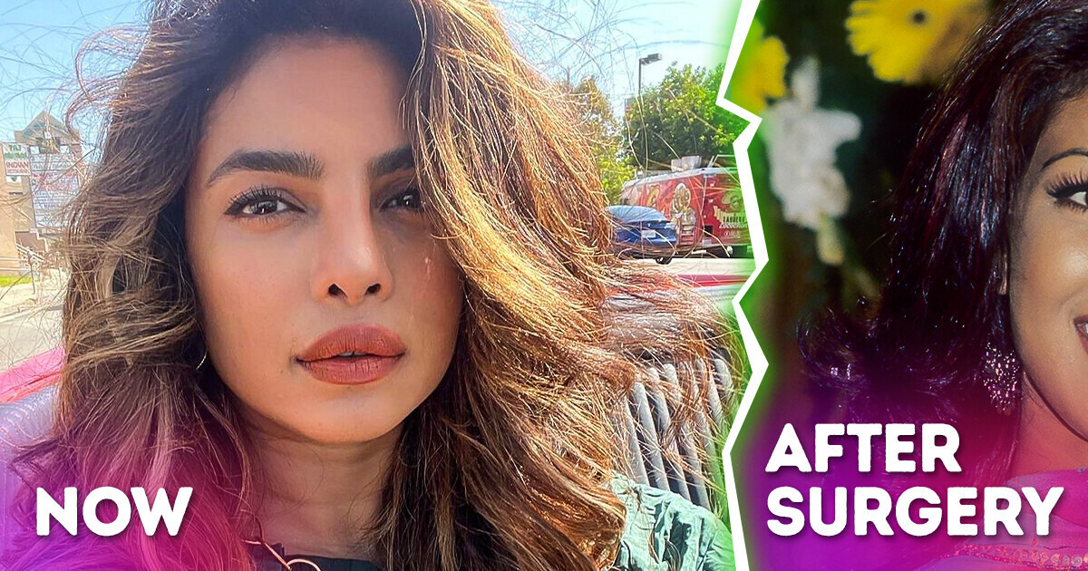 “I Wasn’t Me”: How a Botched Plastic Surgery in the 2000s Nearly Ruined Priyanka Chopra’s Life “I Wasn’t Me”: How a Botched Plastic Surgery in the 2000s Nearly Ruined Priyanka Chopra’s Life