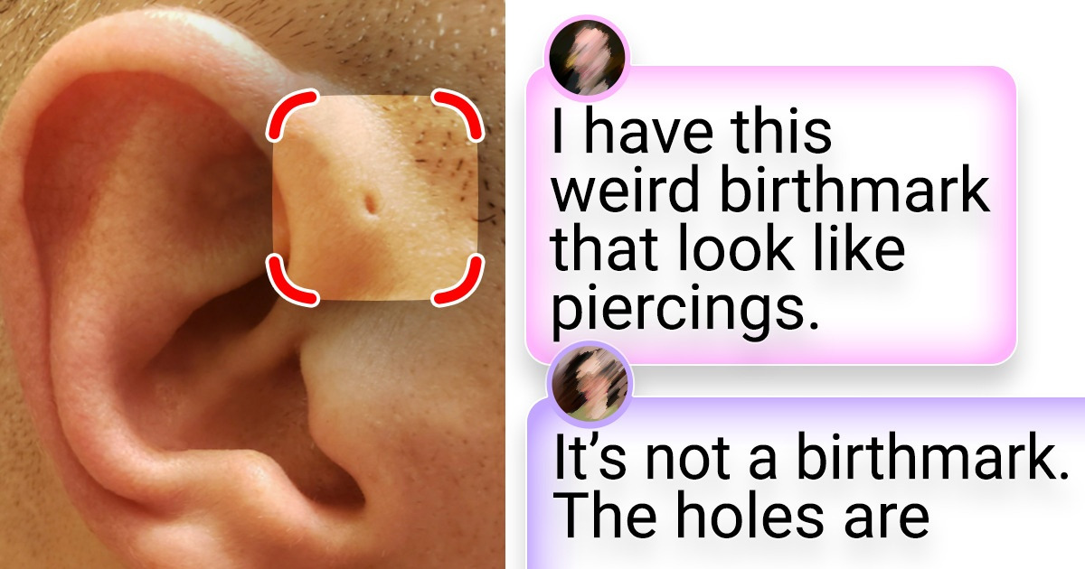 15+ People Who Were Casted in a Unique Mold
