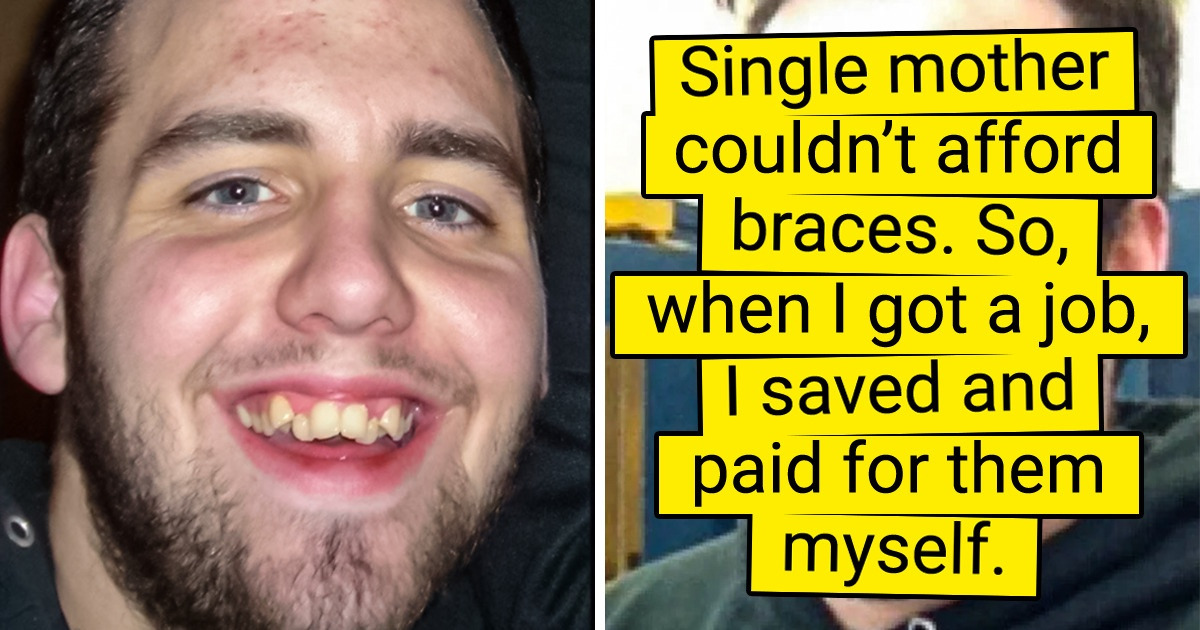 15 People Who Decided to Fix Their Crooked Teeth and Now Feel Amazing 15 People Who Decided to Fix Their Crooked Teeth and Now Feel Amazing
