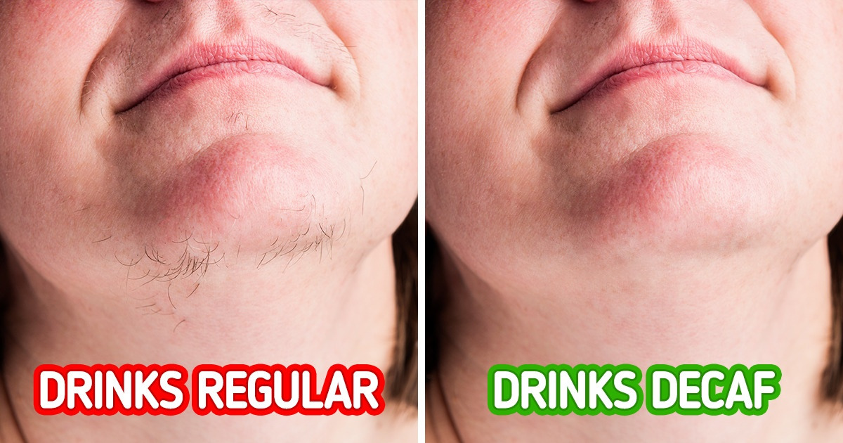 6 Possible Causes of Excess Hair Growth and Ways to Deal with Them