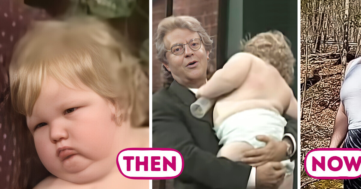 At 17 Months, He Was 70lb—Now at 30, His New Look Stuns Everyone At 17 Months, He Was 70lb—Now at 30, His New Look Stuns Everyone