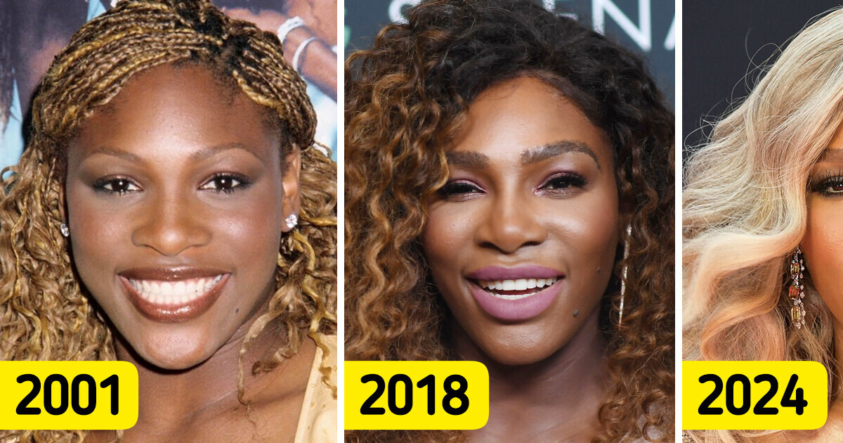 “Calm Down on the Fillers!” Serena Williams Received Backlash for Her Markedly Different Appearance “Calm Down on the Fillers!” Serena Williams Received Backlash for Her Markedly Different Appearance