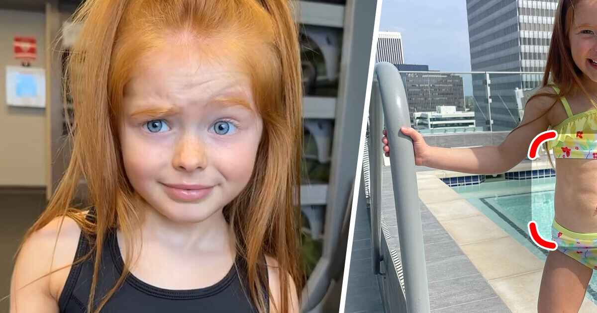 8-Year-Old Girl Sparks Heated Debate Over Her “Confusing Belly” — Mom Steps In 8-Year-Old Girl Sparks Heated Debate Over Her “Confusing Belly” — Mom Steps In