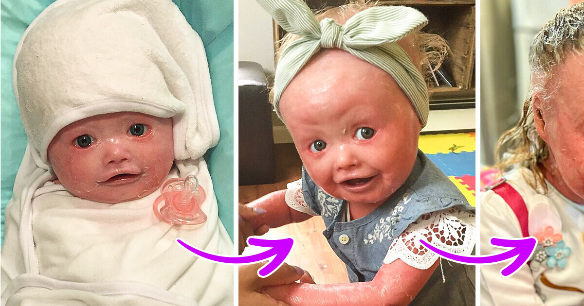 Parents Left Shocked by Their Newborn’s Look — Now She’s 6 and They Call Her a Little “Beauty Queen” Parents Left Shocked by Their Newborn’s Look — Now She’s 6 and They Call Her a Little “Beauty Queen”