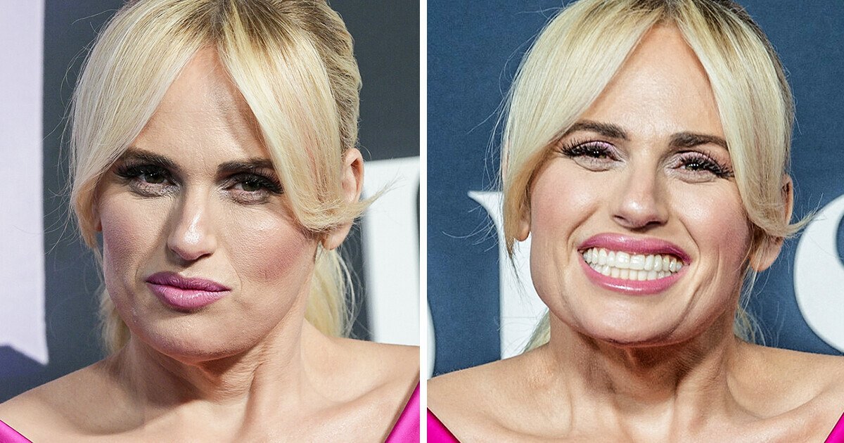 15+ Stars Who Prove That a Simple Smile Can Make Us Infinitely More Beautiful