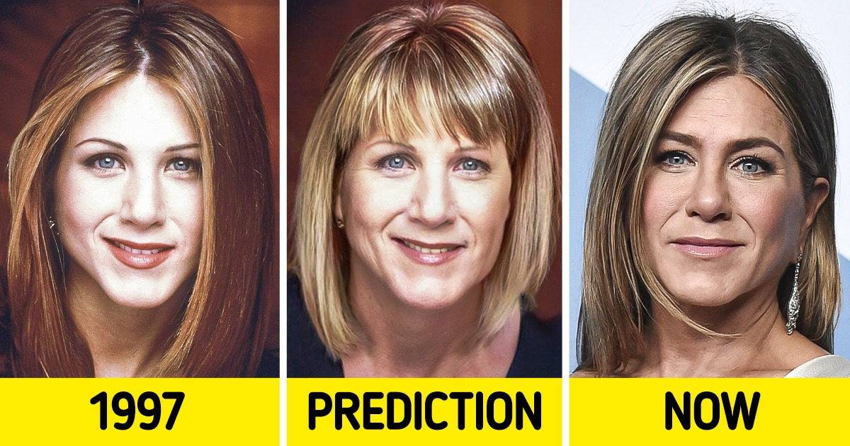 12 Celebrities That Would Look Very Different If It Wasn’t for Beauty Treatments 12 Celebrities That Would Look Very Different If It Wasn’t for Beauty Treatments