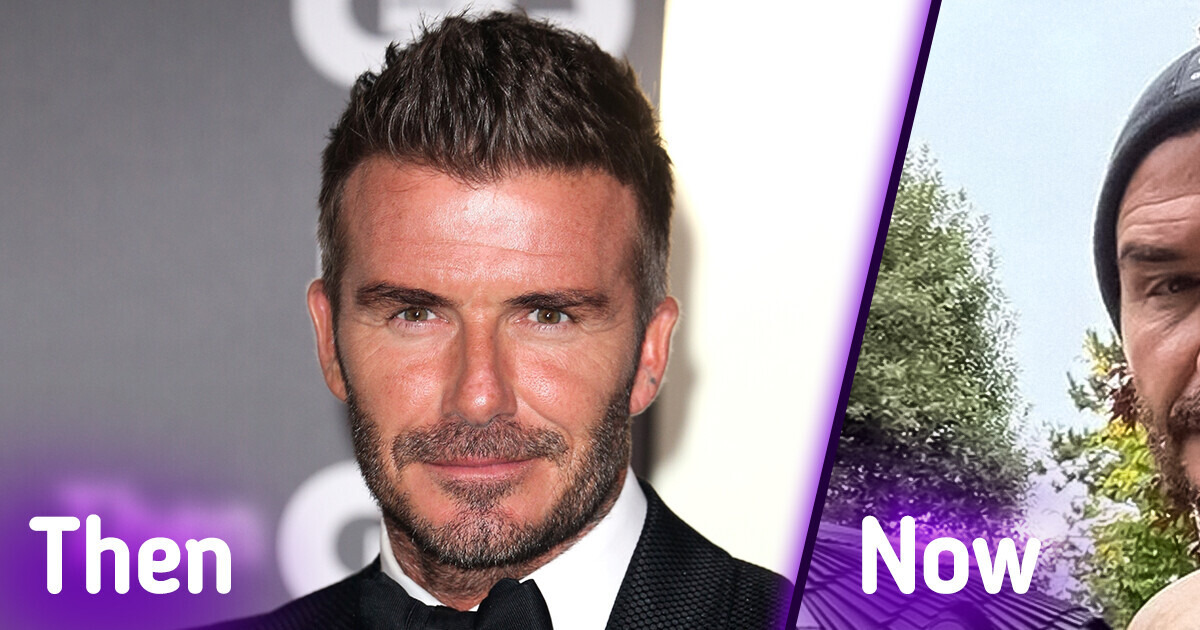 “Too Much Botox,” David Beckham’s Swollen Face in Latest Photos Sparks Heated Controversy “Too Much Botox,” David Beckham’s Swollen Face in Latest Photos Sparks Heated Controversy