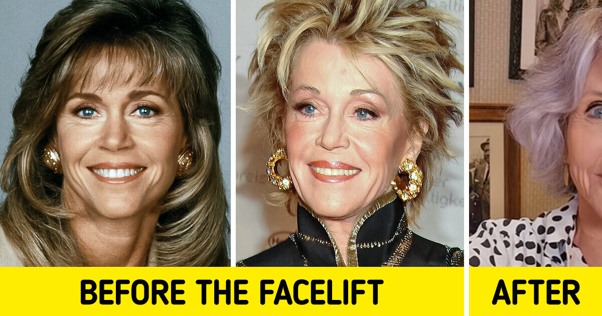 85-Year-Old Jane Fonda Honestly Admitted That She Regrets Getting a Facelift 85-Year-Old Jane Fonda Honestly Admitted That She Regrets Getting a Facelift