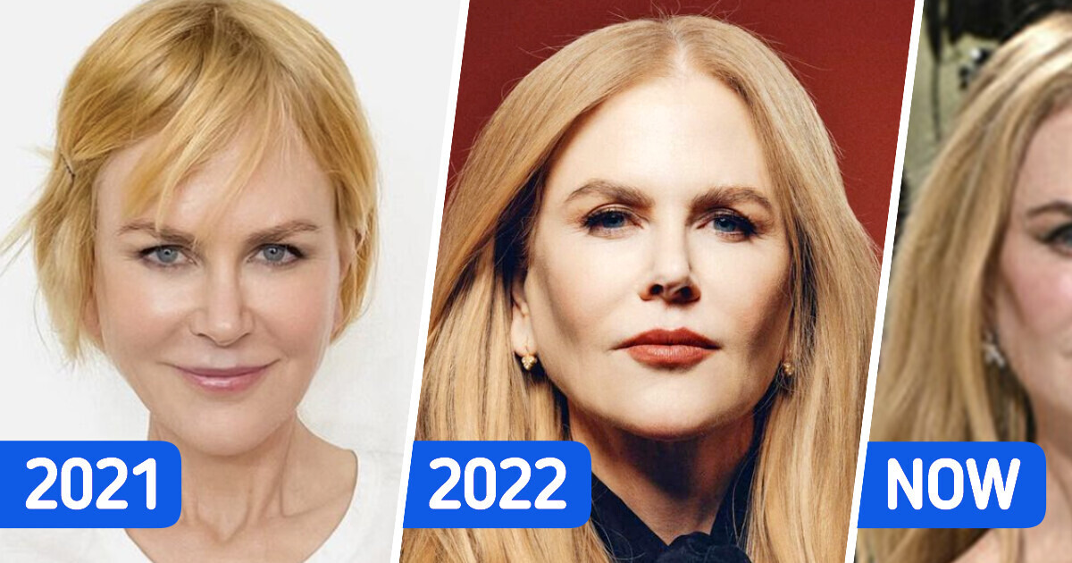 “She Has a Different Face Every Year”, Nicole Kidman’s Recent Look Bothered Fans “She Has a Different Face Every Year”, Nicole Kidman’s Recent Look Bothered Fans