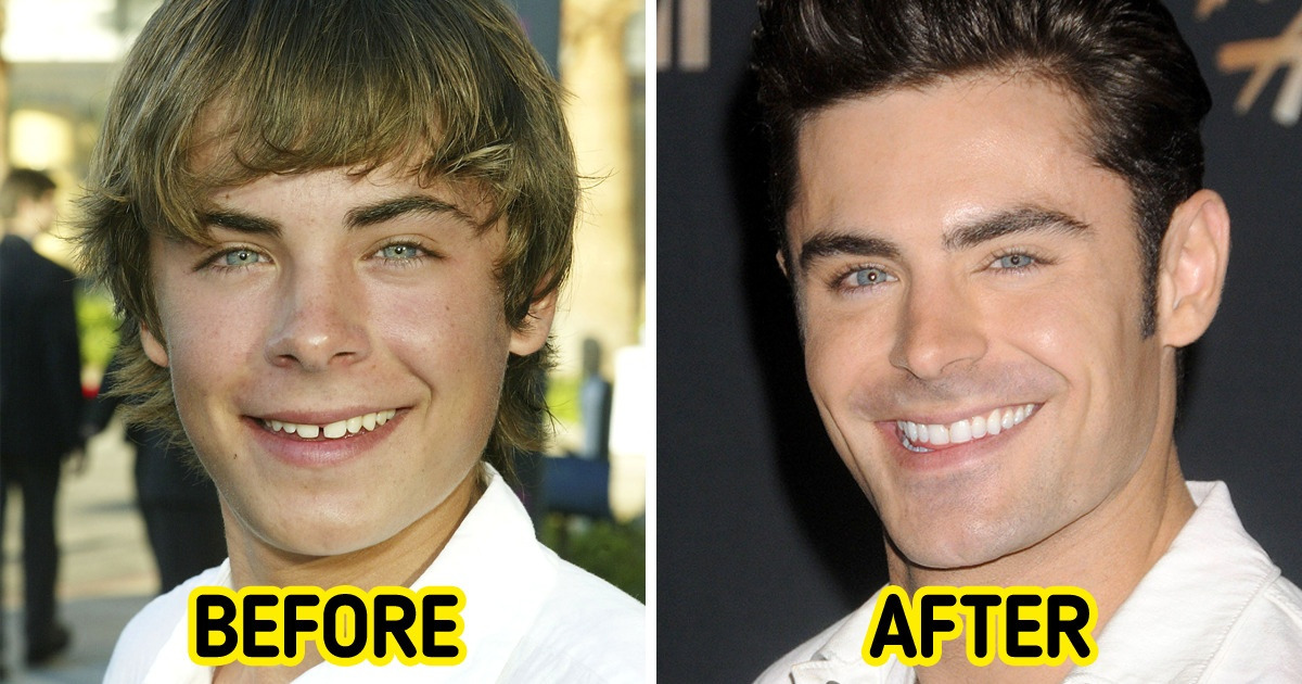 15+ Celebrities Who Got a Smile of Their Dreams