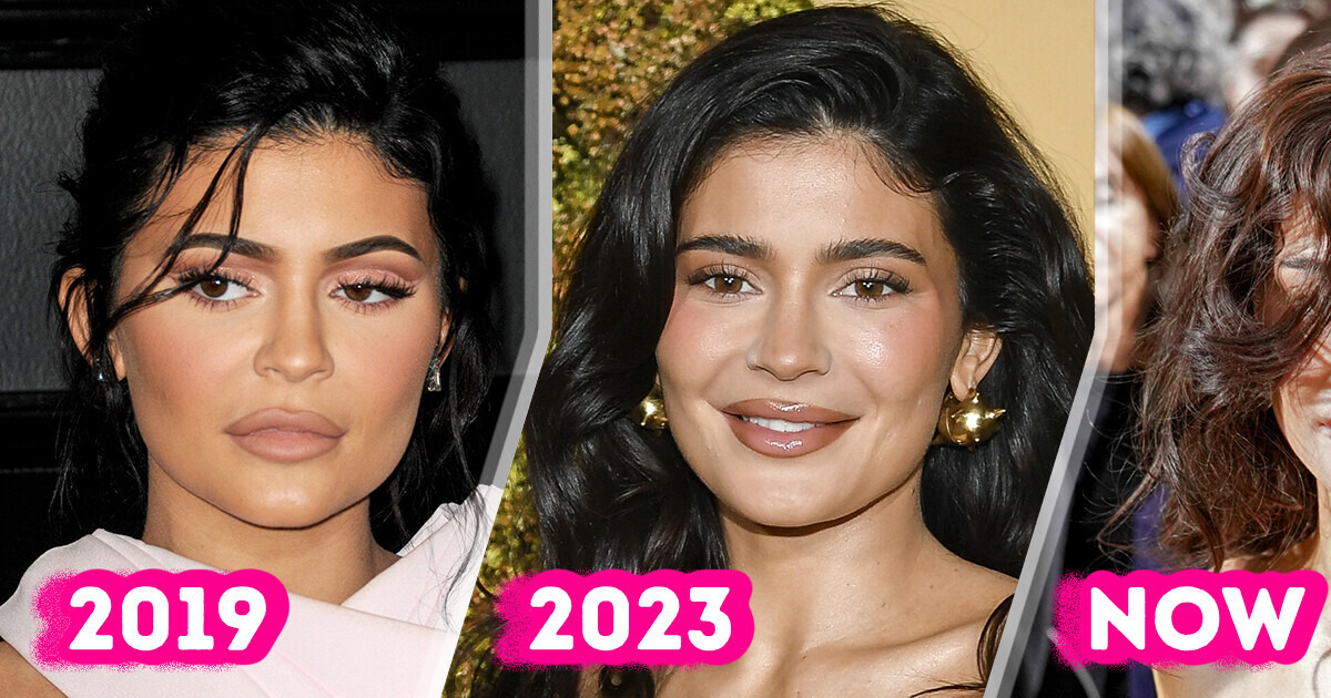 Why Kylie Jenner’s Face Has Suddenly Started Looking Different Recently Why Kylie Jenner’s Face Has Suddenly Started Looking Different Recently