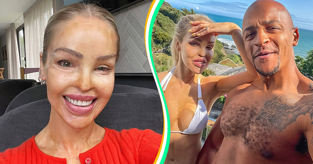 Meet Katie Piper, Who Underwent an Acid Attack and Endured 400 Surgeries to Learn to Love Herself and Create a Family Meet Katie Piper, Who Underwent an Acid Attack and Endured 400 Surgeries to Learn to Love Herself and Create a Family