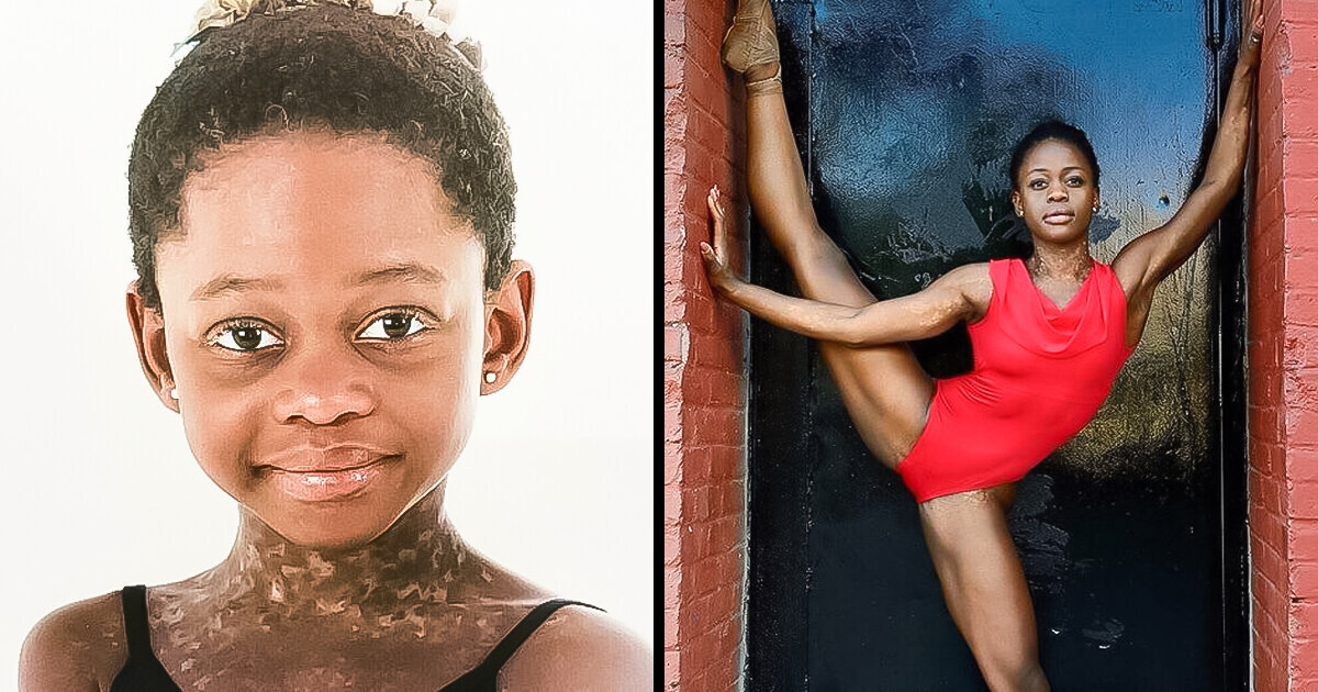 She Was Called the “Devil’s Child” in the Orphanage, but Now She is a Prima Ballerina