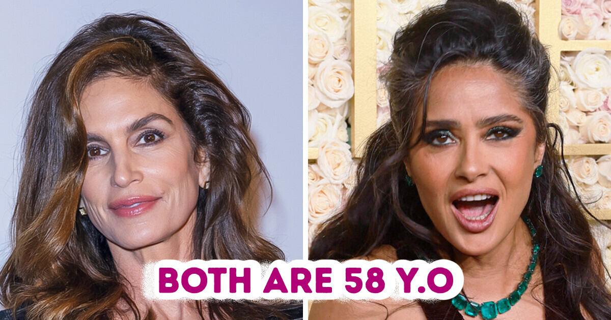 Side-by-Side Photos of Same-Age Stars with Cosmetic Procedures and Without