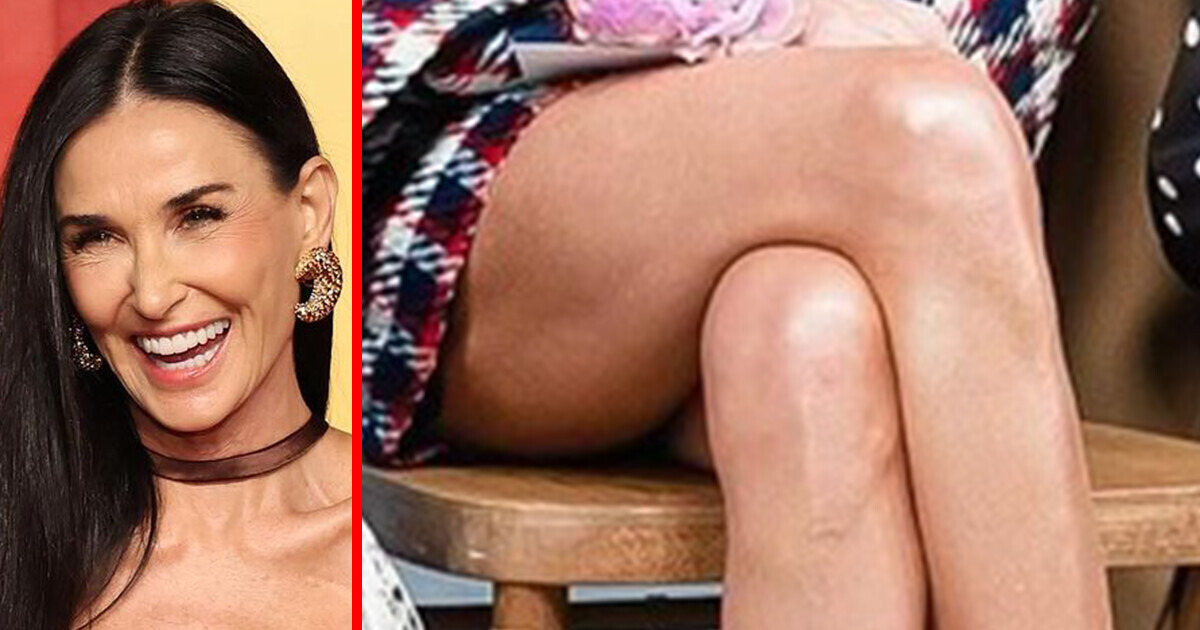 «Her Knees Look Old!» People Online Are Discussing Demi Moore’s Legs and We Think She Looks Gorgeous «Her Knees Look Old!» People Online Are Discussing Demi Moore’s Legs and We Think She Looks Gorgeous